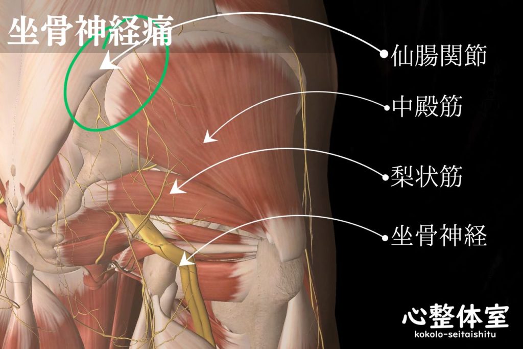 坐骨神経痛・仙腸関節・中殿筋・梨状筋・坐骨神経