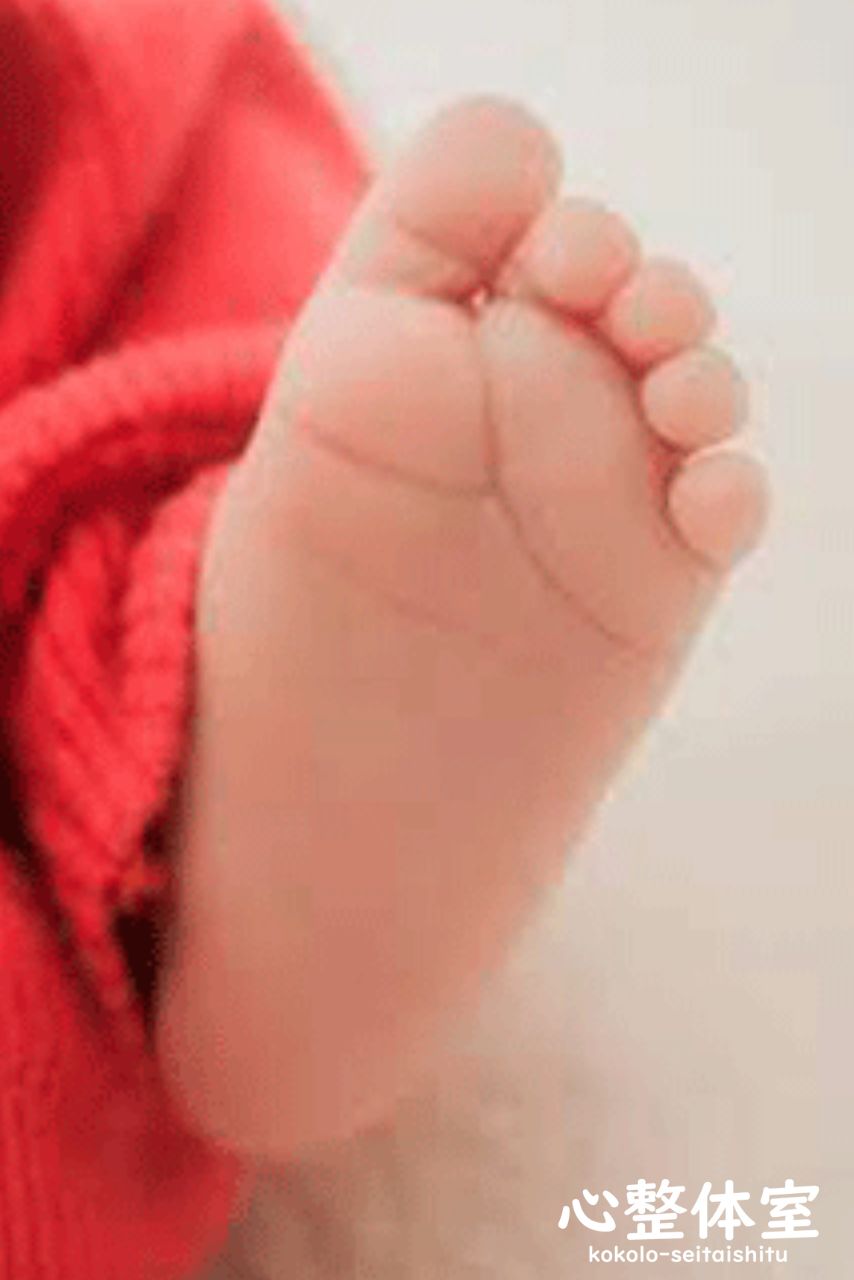 扁平足、赤ちゃんの足の裏