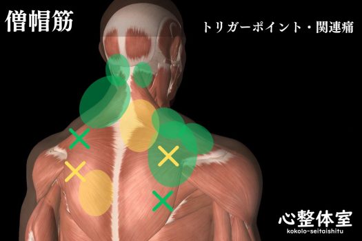 僧帽筋トリガーポイント関連痛02