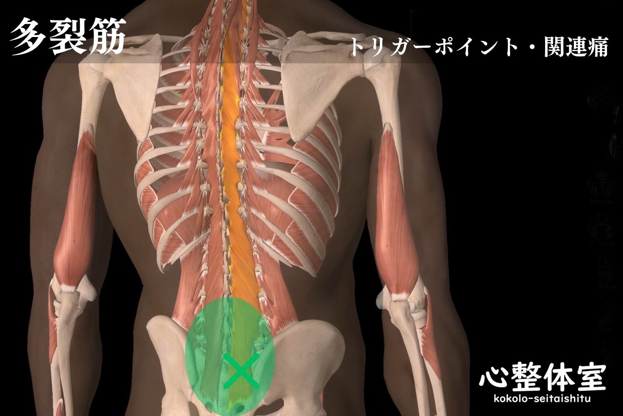 多裂筋下部トリガーポイント