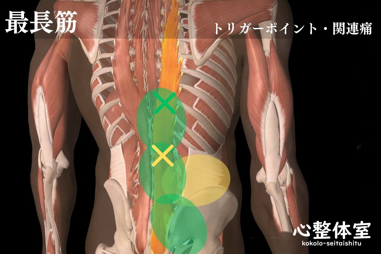 最長筋トリガーポイント