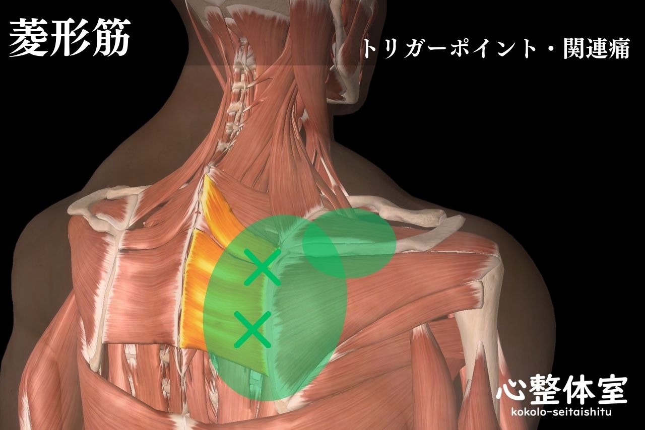 菱形筋トリガーポイント