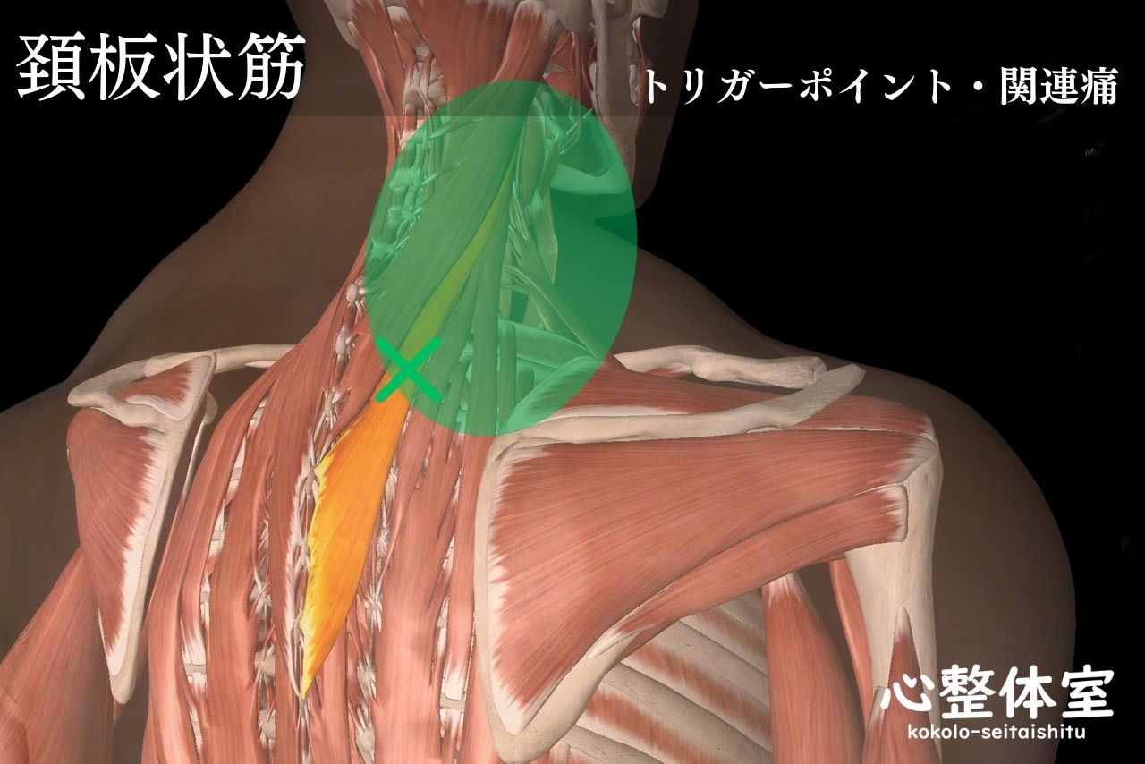 頚板状筋トリガーポイント