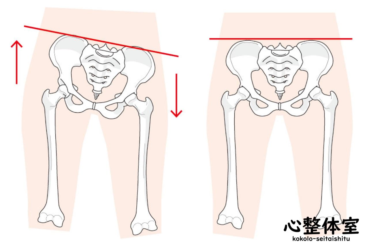 骨盤が歪む