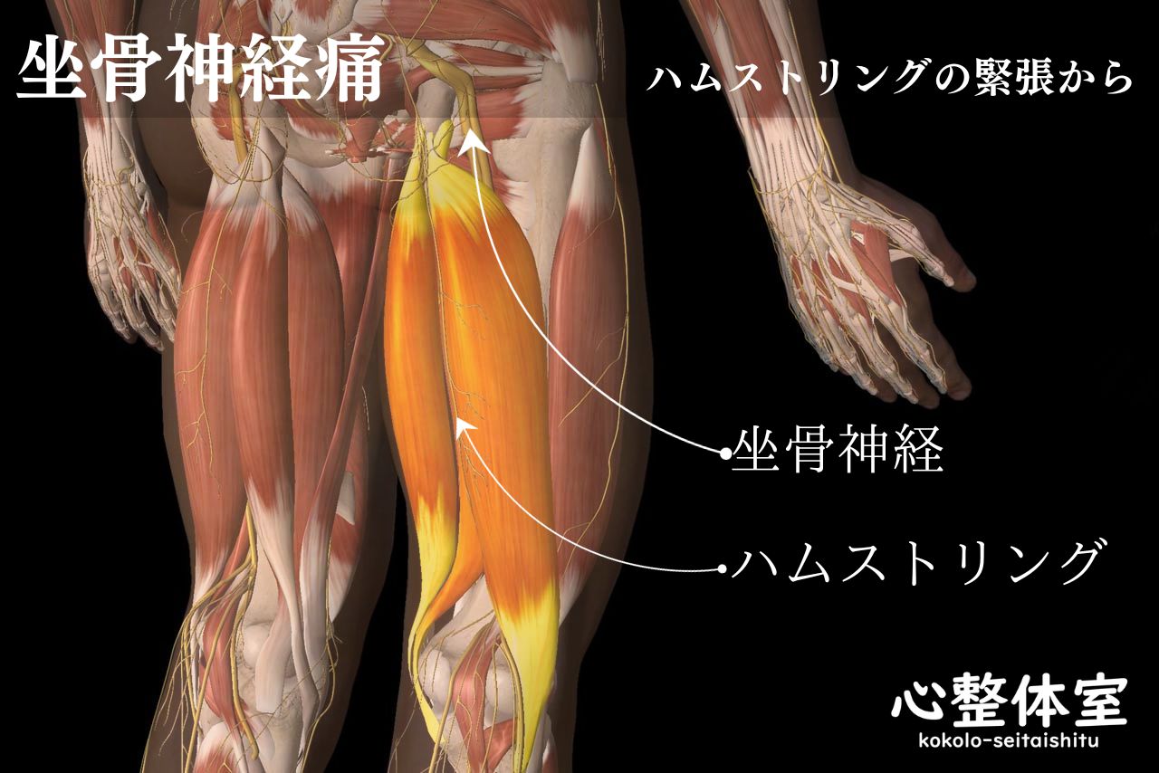 ハムストリング・坐骨神経痛
