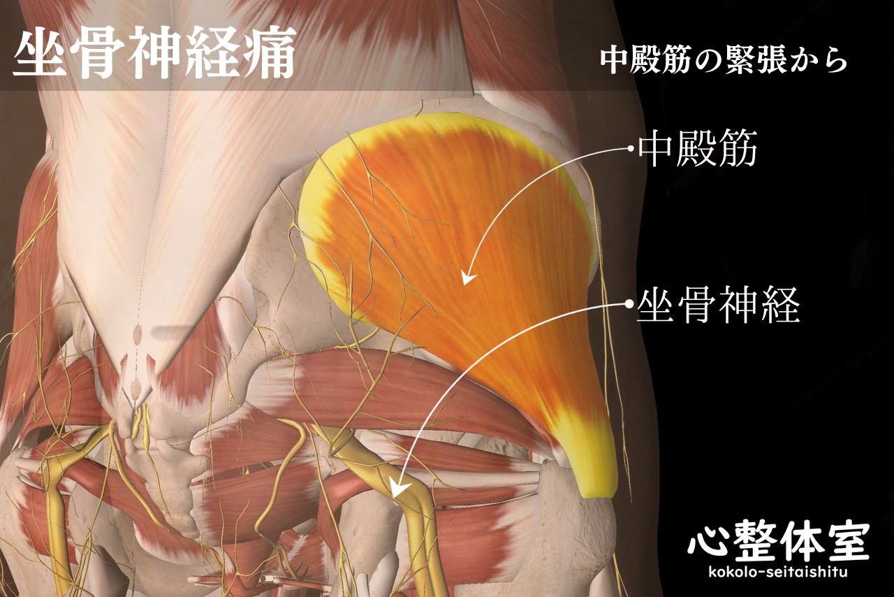 中殿筋・坐骨神経痛