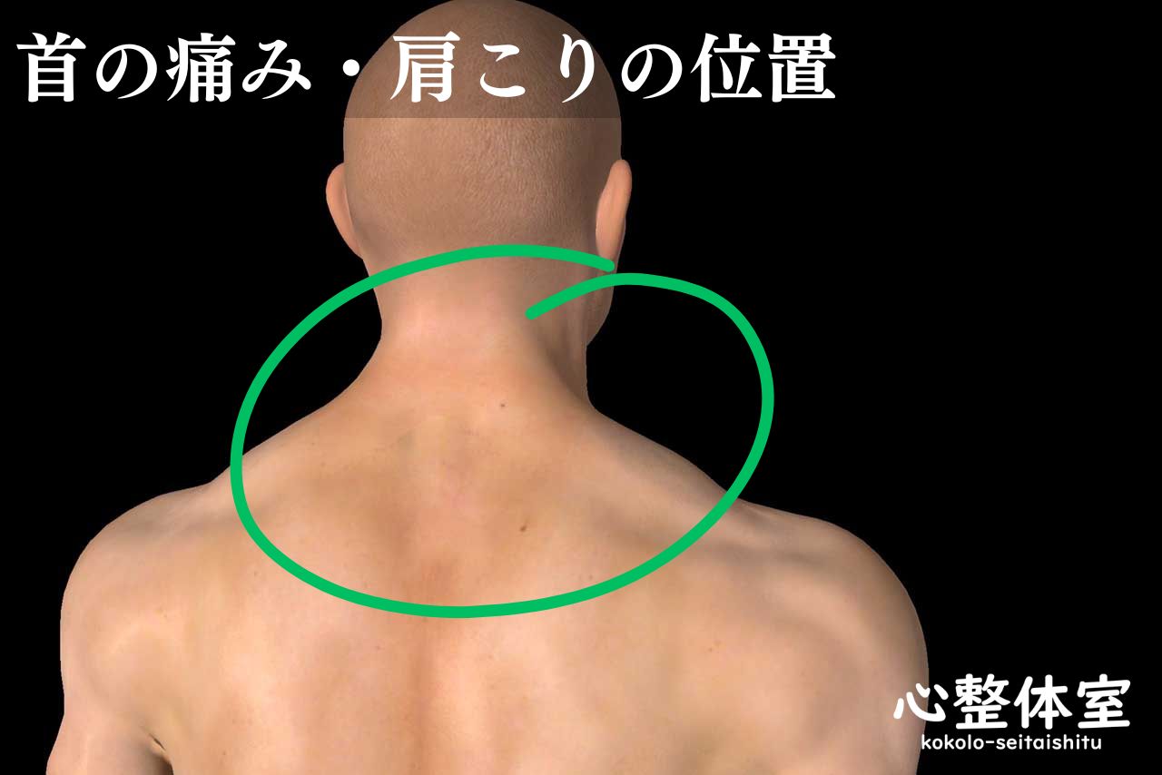 首の痛み・肩こりの位置