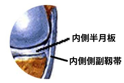 内側側副靱帯と内側半月板拡大